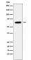 Anti-Estrogen Receptor alpha Rabbit Monoclonal Antibody